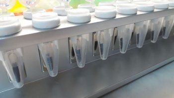 El test permitir&aacute; diagnosticar coronavirus con mayor rapidez.&nbsp;