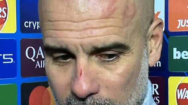 Guardiola, lastimado tras un inesperado empate del Manchester City.