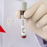 La falta de campañas de prevención y el acceso limitado a preservativos aumentan la propagación del virus. La falta de campañas de prevención y el acceso limitado a preservativos aumentan la propagación del virus.