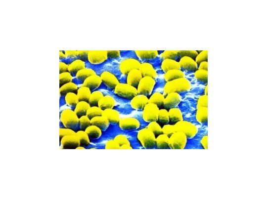 Empleados de un laboratorio de EEUU estuvieron expuestos al ántrax.