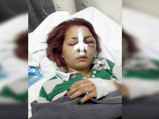 Priscila Barreto luego del ataque