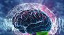 Cerebro.