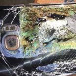 Un adolescente sufrió graves heridas tras la explosión de su celular. Un adolescente sufrió graves heridas tras la explosión de su celular.