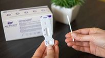bioquimicos, contra el autotest de covid-19