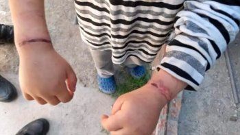 Grave denuncia en Moreno: rescatan a dos niños brutalmente maltratados por sus padres.