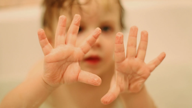 This reaction occurs both for children and for the elderly. This reaction occurs both for children and for the elderly.