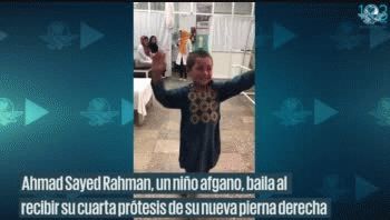 Felicidad en medio de la tragedia: niño víctima de la guerra baila tras recibir pierna ortopédica