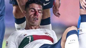 cristiano ronaldo recibio un violento golpe en la cara y genero preocupacion