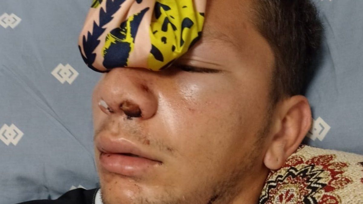 He was attacked playing football, he convulsed and was miraculously saved: “God kept him alive”