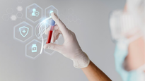 Harvard predijo un cáncer años antes de que aparezcan los síntomas gracias a la inteligencia artificial.