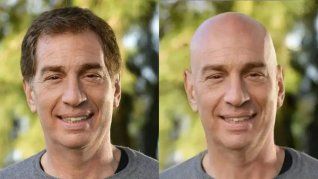Diego Santilli lanzó una encuesta en redes sociales y sometió a votación si cortarse o no el cabello.  Diego Santilli lanzó una encuesta en redes sociales y sometió a votación si cortarse o no el cabello.