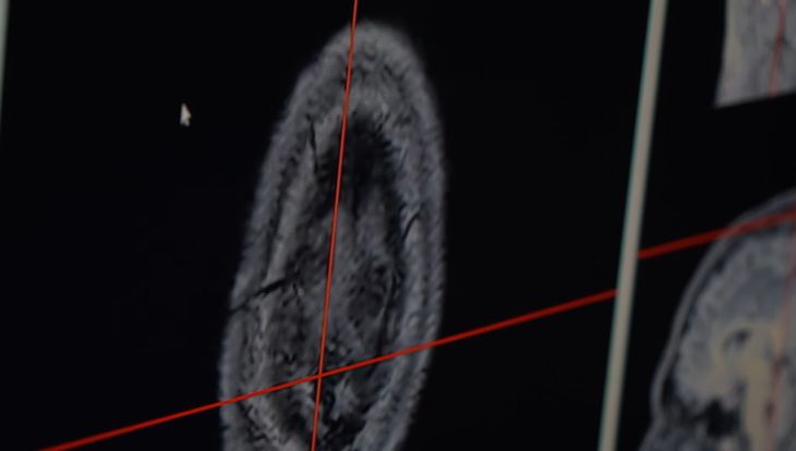 El Hospital Tránsito Cáceres de Allende marca un hito en la neurocirugía pública de Córdoba. El Hospital Tránsito Cáceres de Allende marca un hito en la neurocirugía pública de Córdoba.