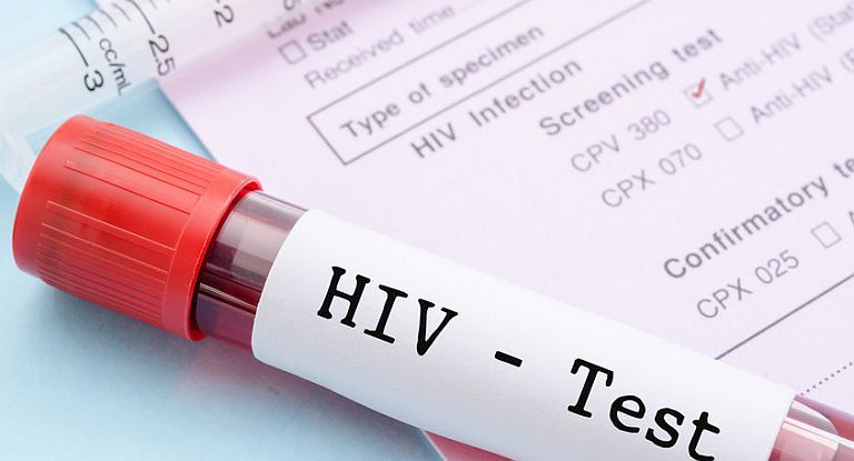 La efem&eacute;ride se conmemora con el objetivo de informar y dar a conocer la situaci&oacute;n de la enfermedad, y concientizar sobre prevenci&oacute;n, tratamiento y atenci&oacute;n a las personas que conviven con el virus.