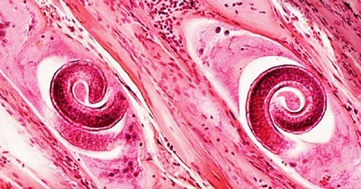 hay al menos 40 casos confirmados de triquinosis.