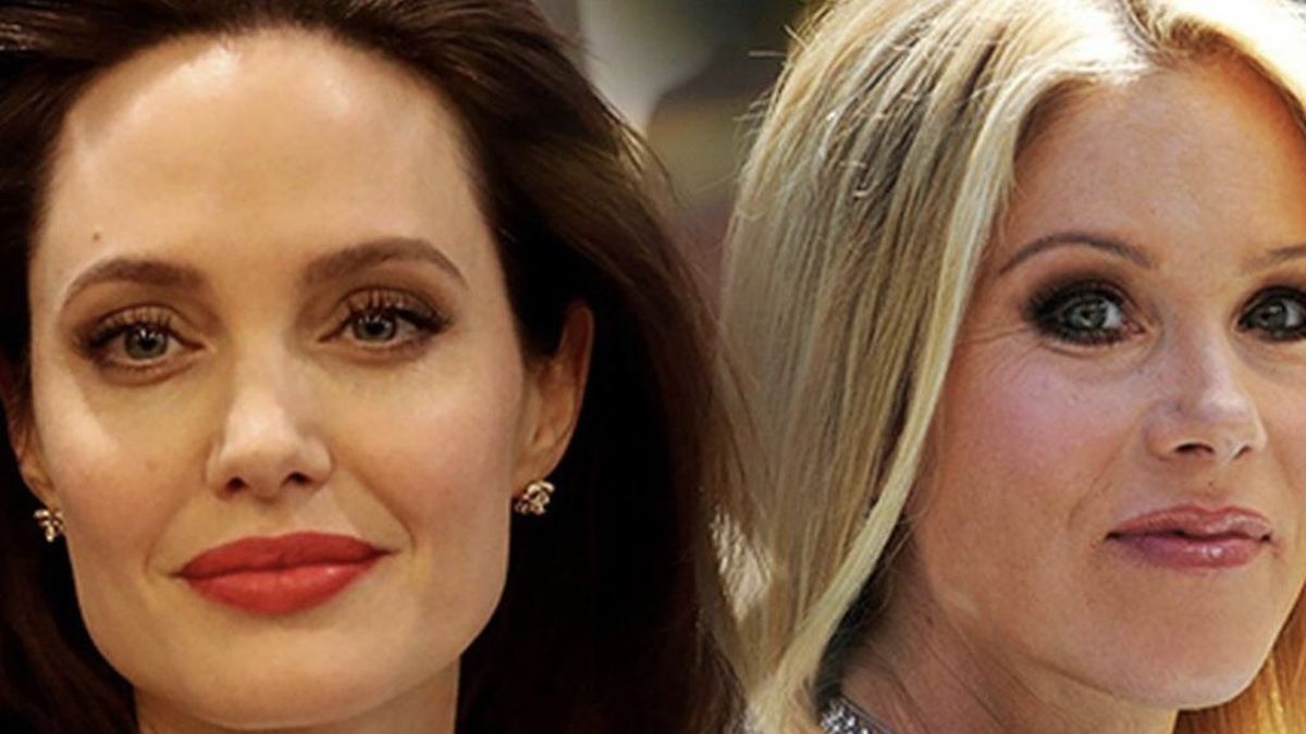 Angelina Jolie and Christina Applegate, celebrities who removed their ovaries to prevent cancer