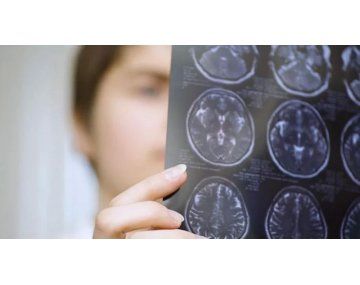 A pesar de atacar a la misma parte del cuerpo, ELA y esclerosis múltiple son enfermedades distintas. A pesar de atacar a la misma parte del cuerpo, ELA y esclerosis múltiple son enfermedades distintas.