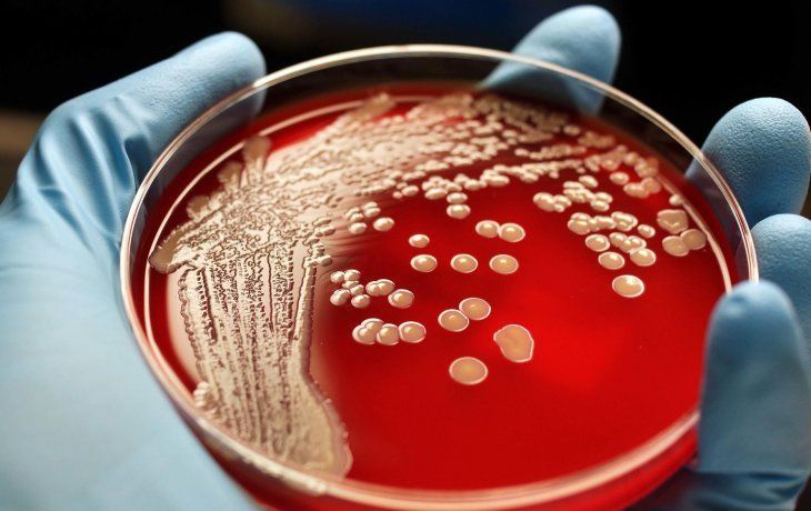 La peligrosa bacteria que actúa en silencio La peligrosa bacteria que actúa en silencio