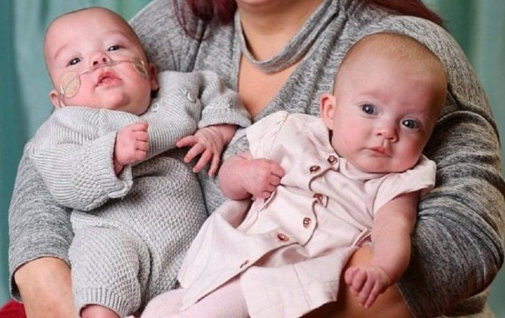 Insólito: una mujer tuvo gemelas con 12 días de diferencia