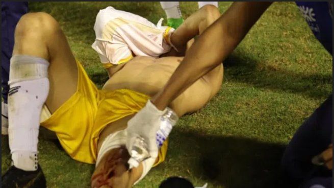 Así quedó el jugador brasileño tras el tiro perpetrado por un policía local