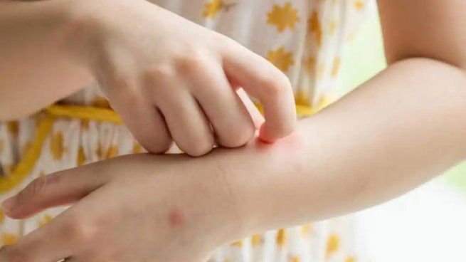 ¿Cómo evitar la picadura de mosquito?&nbsp;