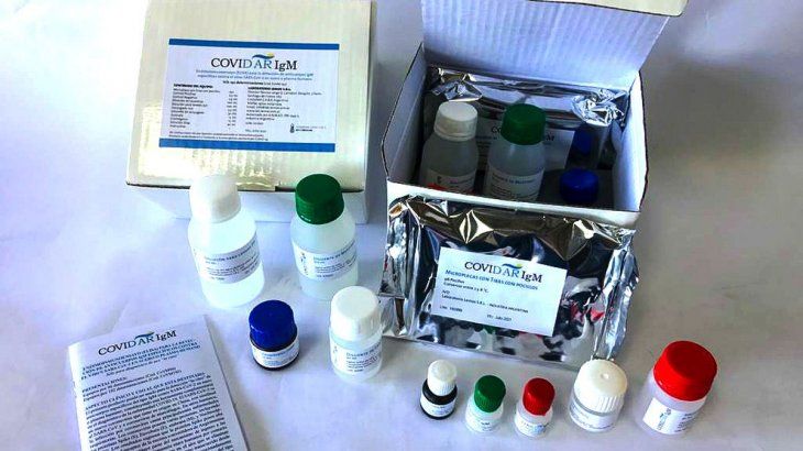 Utilizarán un nuevo test que es más rápido y económico para la detección de Covid-19.