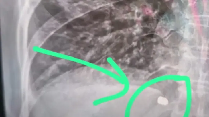 Una mujer de 43 años fue baleada en el pecho mientras navegaba por el arroyo Correntino. Una mujer de 43 años fue baleada en el pecho mientras navegaba por el arroyo Correntino.