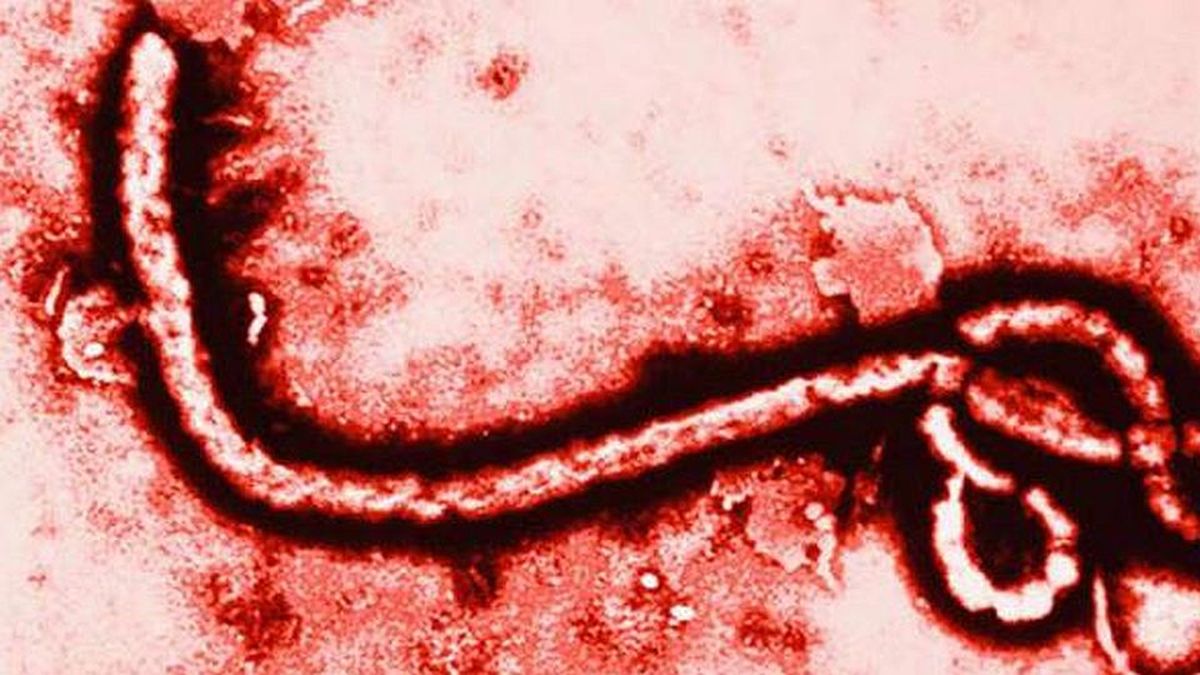 Virus del ébola puede permanecer en semen hasta año y medio