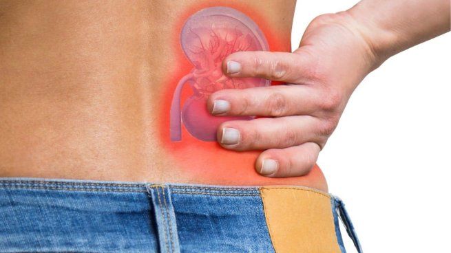 Las piedras de calcio aparecen por la falta de agua.&nbsp;