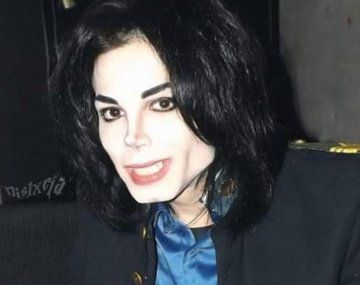 Confundieron al imitador argentino de Michael Jackson con Felipe Pettinato y lo golpearon