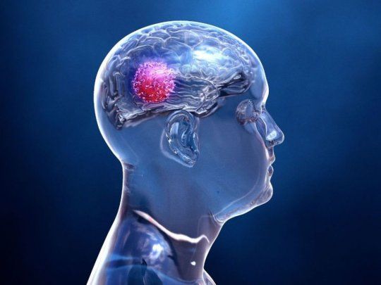 Cerebro.