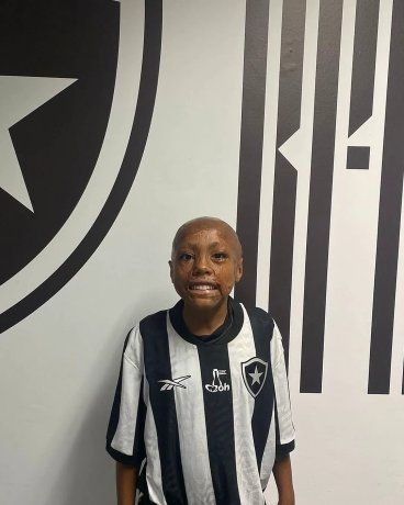 Bernando Lopes is eleven years old and dreams of being a professional soccer player.