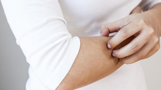 Rascarse la piel de forma frecuente puede estar vinculado a la ansiedad, estrés o hábitos inconscientes.