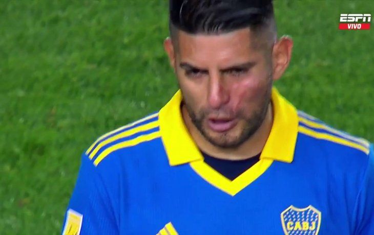 Golpe. Así salía Zambrano a jugar el segundo tiempo con Racing tras la pelea con Benedetto en el entretiempo.