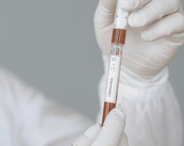 La compra inicial sería de 225 millones de vacunas, una vez que se demuestre que la vacuna es eficaz. Este es el cuarto acuerdo de este tipo que Europa firma con laboratorios.