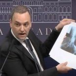 Manuel Adorni, cuando confundió la radiografia de un perro con la de una personal. El vocero suspendió las conferencias de prensa y es un activo tóxico de La Libertad Avanza. Manuel Adorni, cuando confundió la radiografia de un perro con la de una personal. El vocero suspendió las conferencias de prensa y es un activo tóxico de La Libertad Avanza.