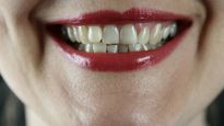Los especialistas explican el motivo por el que los dientes se ponen amarillos.