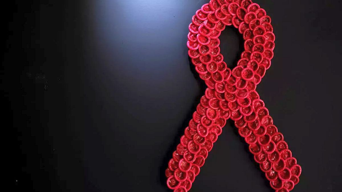 HIV is current