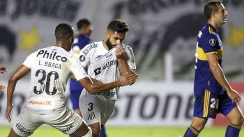 Inoportuno. Boca perdió con Santos y se complicó en la Copa Libertadores justo antes de recibir a River por la Copa de la Liga.