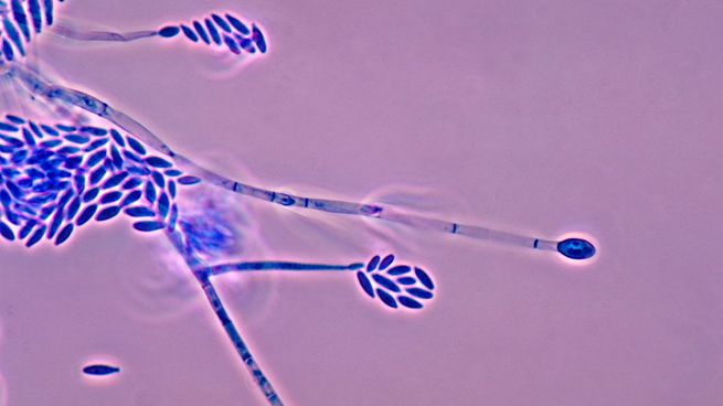 Fusarium graminearum, el hongo que ataca a los cultivos.