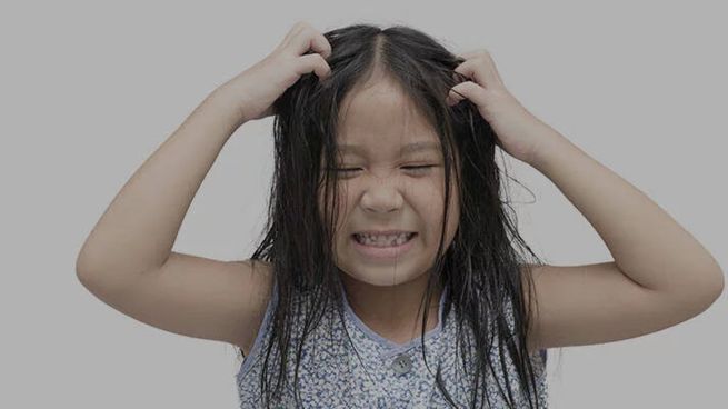 Los piojos se contagian generalmente en las escuelas.