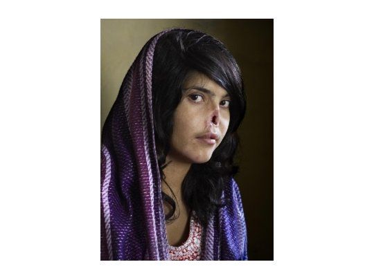 Vea las mejores fotos ganadoras.