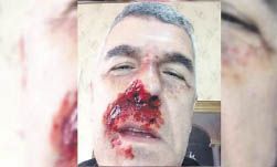 De mal gusto la foto y la “broma” de Dady Brieva.