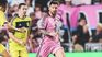Hither and thither. Messi's injury worries the National Team and Inter Miami. Hither and thither. Messi's injury worries the National Team and Inter Miami.