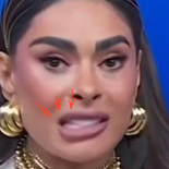 Galilea Montijo y su problema con la boca.