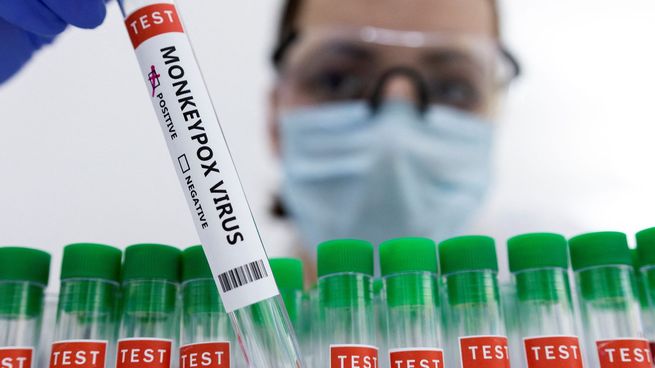 170 casos confirmados de viruela del mono en la Argentina.
