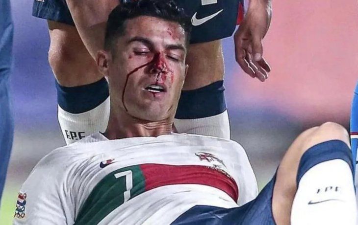 cristiano ronaldo recibio un violento golpe en la cara y genero preocupacion