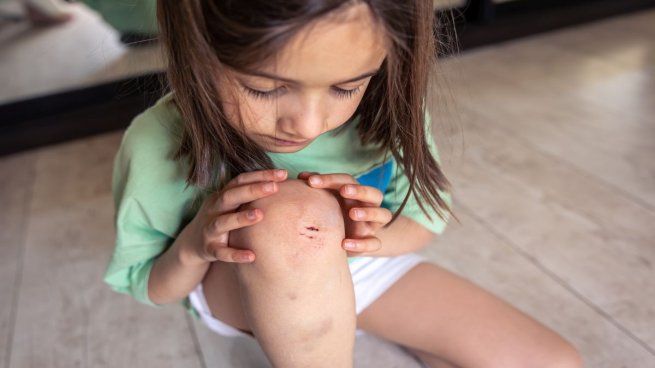 La cicatrización ocurre cada vez que alguna persona se le produce alguna herida.