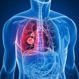 Crecen los casos de enfermedades respiratorias en Argentina. Crecen los casos de enfermedades respiratorias en Argentina.