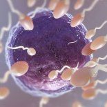 Desde el Clínicas llaman a consultar por técnicas de preservación, que en el caso femenino pasa por el congelamiento o tratamientos de protección ovárica y en el caso masculino un congelamiento de semen. Desde el Clínicas llaman a consultar por técnicas de preservación, que en el caso femenino pasa por el congelamiento o tratamientos de protección ovárica y en el caso masculino un congelamiento de semen.