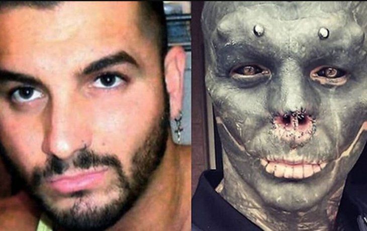 Anthony Loffredo antes y después.